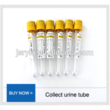 high quality disposable customerized sterile plastic measuring cups medical urine specimen cups